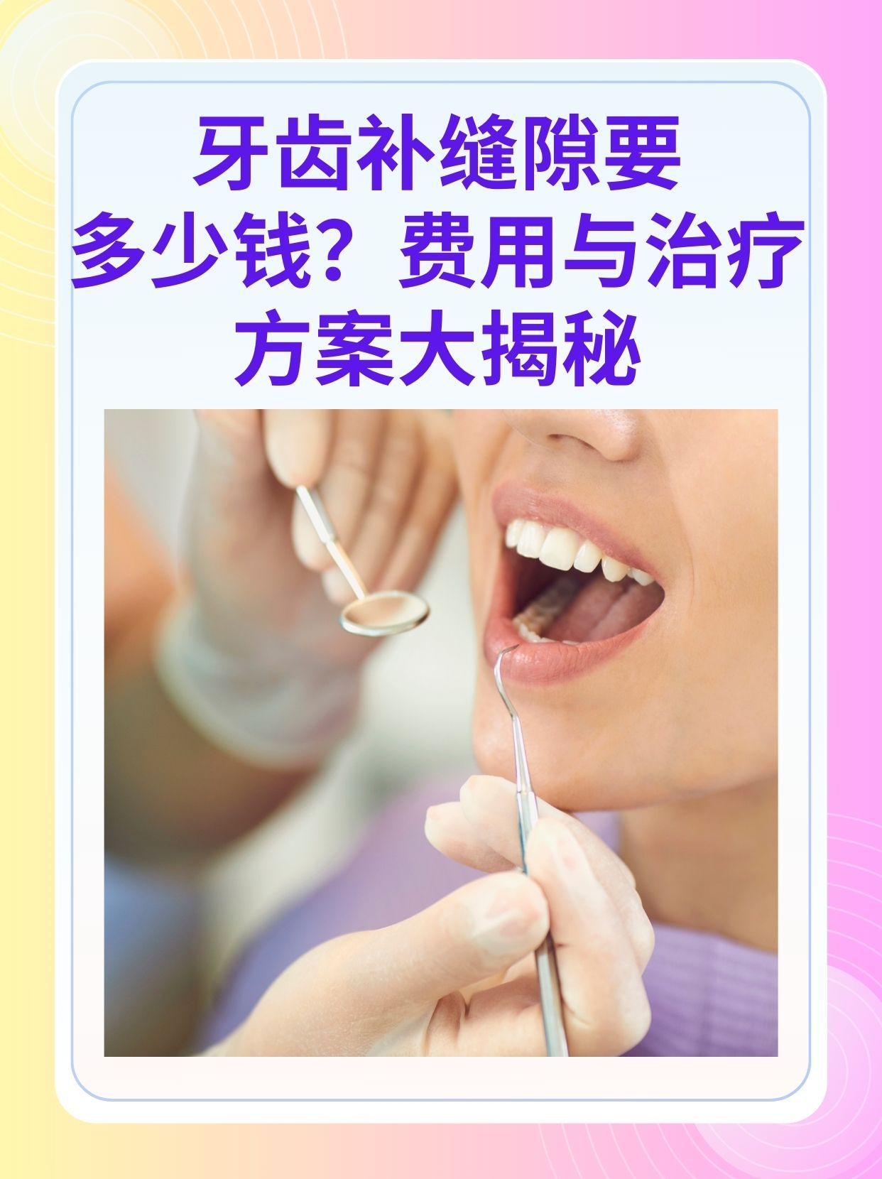 南京补牙医保可以报销吗(补牙医保可以报销吗 哪些可以报销呢)